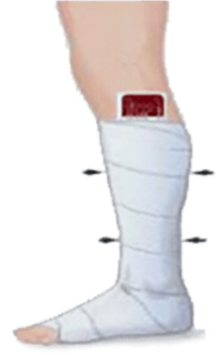 wound-treatment-image